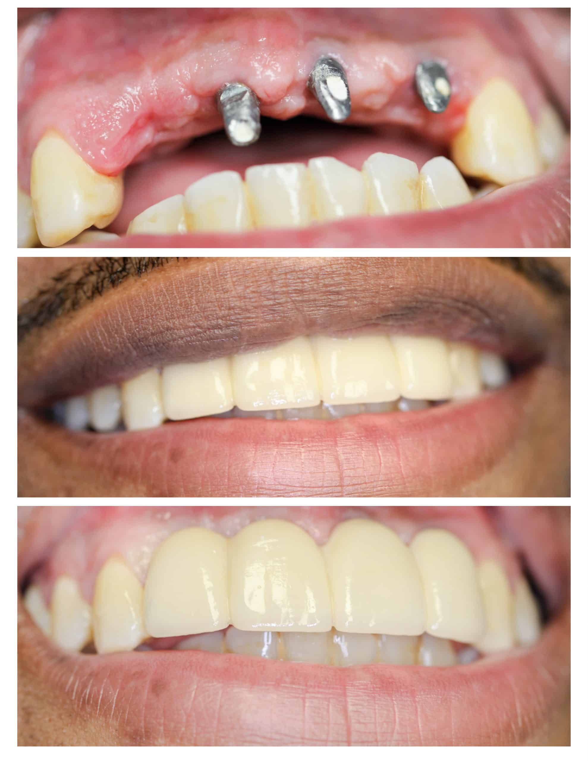 Best dental treatments in PCMC at Sweet Smile Dental Clinic