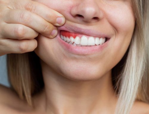 How to Keep Gums Healthy