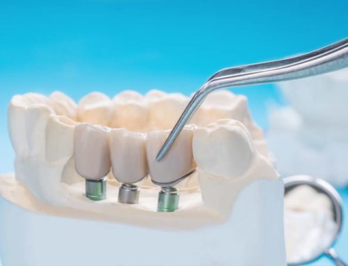 What are the advantages and disadvantages of dental crowns?